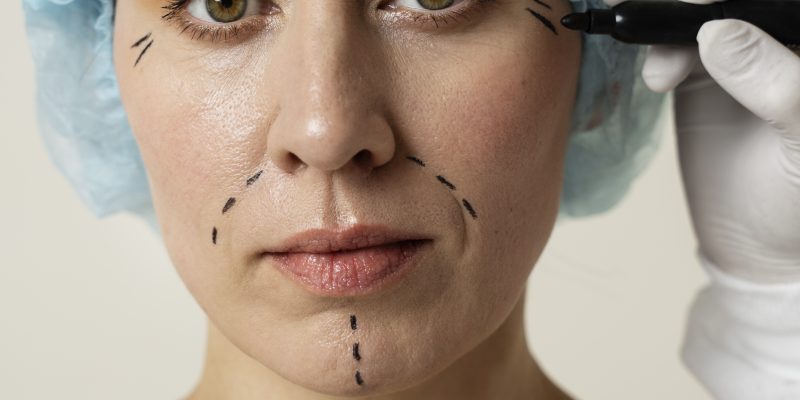 clinica de estética planalto