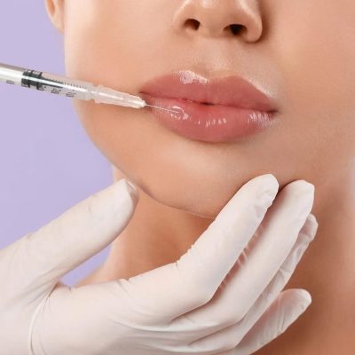 Preenchimento Labial BH